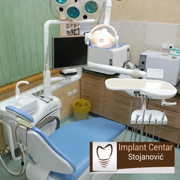 Kompozitne fasete IMPLANT CENTAR STOJANOVIĆ - Implant Centar Stojanović - 1