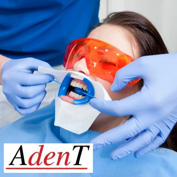 Beljenje zuba ADENT - Stomatološka ordinacija AdenT - 2
