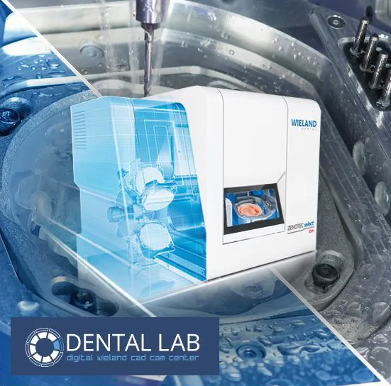 Zubne proteze DENTAL LAB - Dental Lab - 2