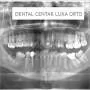 Ortopan digitalni DENTAL CENTAR LUKA ORTO - Dental centar Luka Orto - 2
