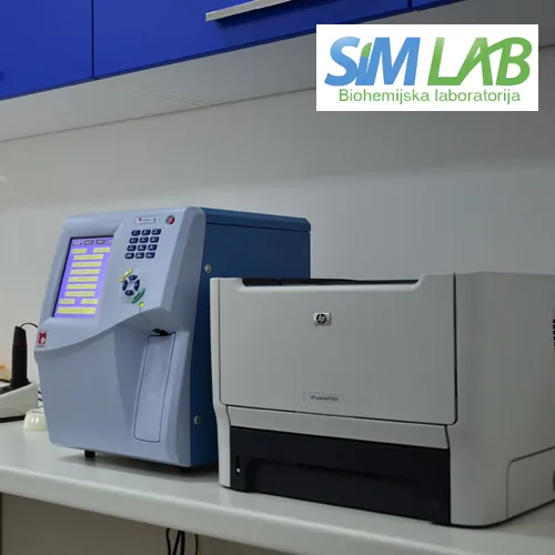 Sedimentacija eritrocita SIM LAB - Laboratorija za medicinsku biohemiju SIM LAB - 2