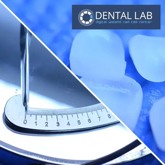 Zubni implanti DENTAL LAB - Dental Lab - 2