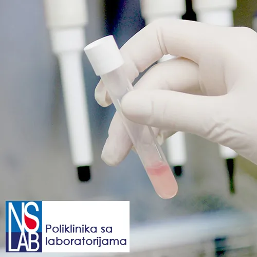Patohistologija NS LAB - Laboratorije NS LAB - 2