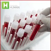 Intolerancija na hranu HUMAN LABORATORIJE - Human laboratorije - 1