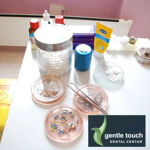 Zalivanje fisura GENTLE TOUCH DENTAL CENTAR - Stomatološka ordinacija Gentle touch Dental centar - 2