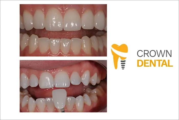 Stomatološka ordinacija Crown Dental - 55