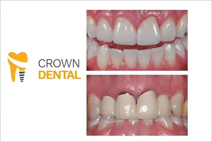 Stomatološka ordinacija Crown Dental - 56