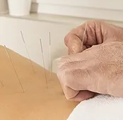 sempre-viva-centar-akupunktura