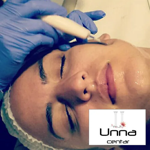 Ultrazvučno čišćenje lica BEAUTY CENTAR UNNA - Beauty Centar Unna - 3