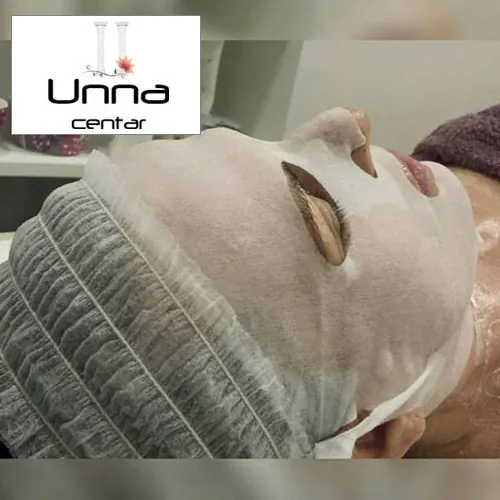 Ultrazvučno čišćenje lica BEAUTY CENTAR UNNA - Beauty Centar Unna - 2
