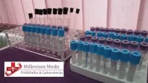 Sedimentacija MILLENIUM MEDIC - Poliklinika i laboratorija Millenium Medic - 1