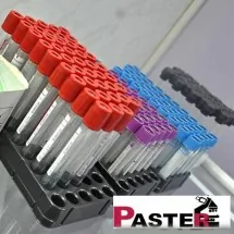 Antitela na TSH receptore PASTER - Zavod za laboratorijsku dijagnostiku PASTER - 2
