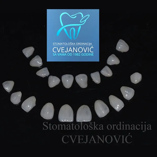 Fasete ORDINACIJA CVEJANOVIĆ - Stomatološka ordinacija Cvejanović - 1