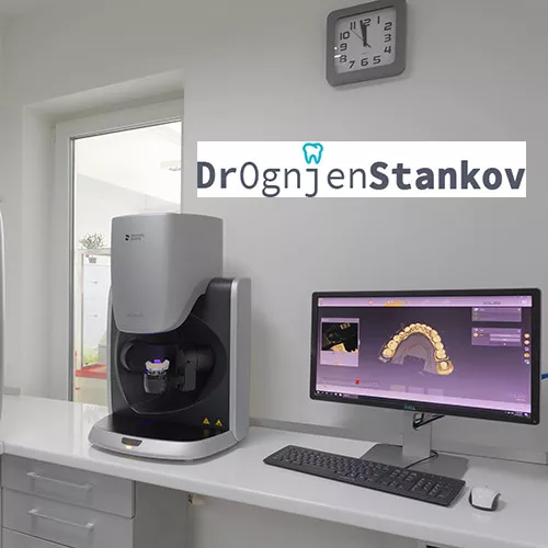 VALPLAST PROTEZA - Stomatološka ordinacija dr Ognjen Stankov - 2