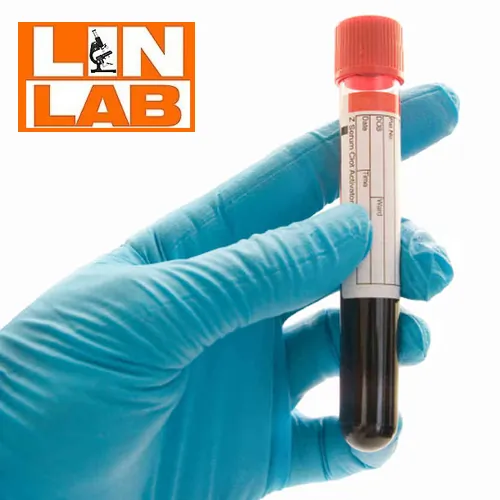 Hormoni štitne žlezde LIN LAB - Laboratorija Lin Lab - 2