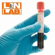 Hormoni štitne žlezde LIN LAB - Laboratorija Lin Lab - 1