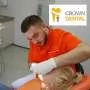 Apikotomija CROWN DENTAL - Stomatološka ordinacija Crown Dental - 1