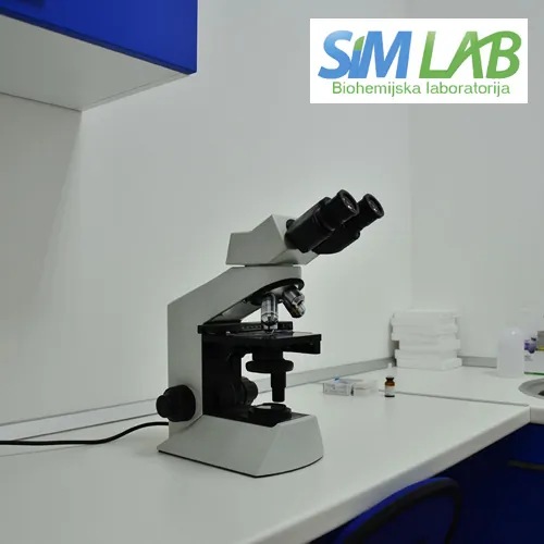 Glukoza SIM LAB - Laboratorija za medicinsku biohemiju SIM LAB - 2