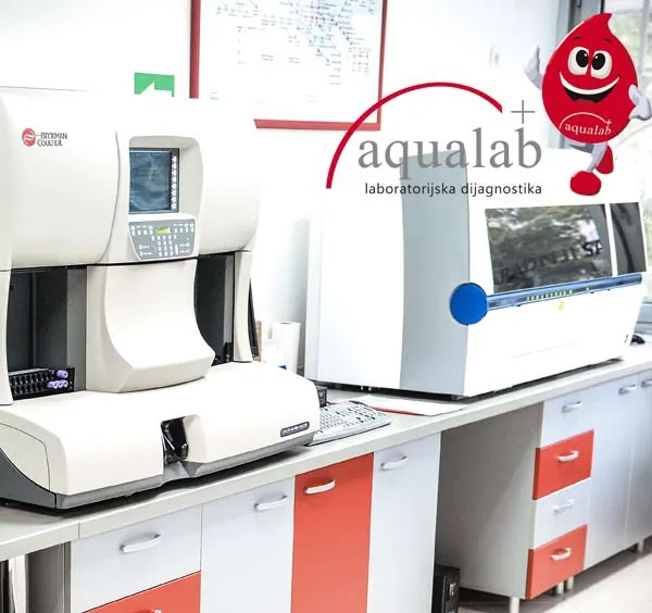 Hematologija AQUALAB - AQUALAB laboratorije - 5