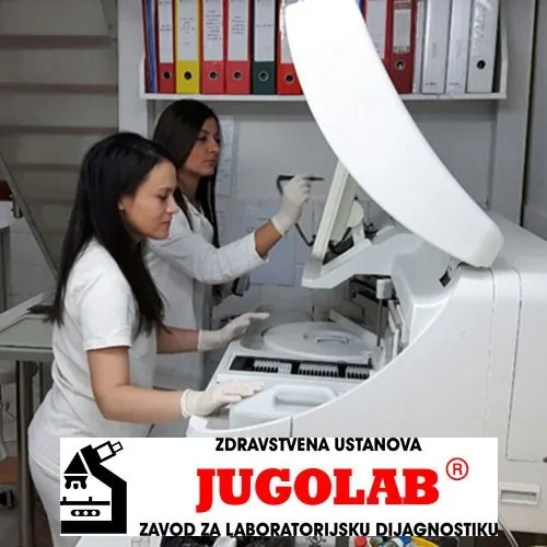 DIJAGNOSTIKA TROMBOFILIJE - JUGOLAB zavod za laboratorijsku dijagnostiku - 2