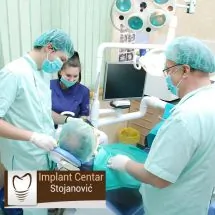 Komplikovano vadjenje zuba IMPLANT CENTAR STOJANOVIĆ - Implant Centar Stojanović - 3