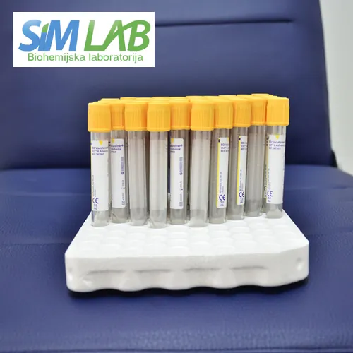 Kreatinin SIM LAB - Laboratorija za medicinsku biohemiju SIM LAB - 2