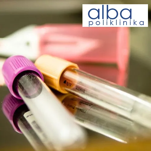 Hormoni POLIKLINIKA ALBA - Poliklinika Alba - 2