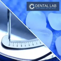 Zubne proteze DENTAL LAB - Dental Lab - 1