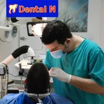 Ugradnja implanta  DENTAL N PLUS - Stomatološka ordinacija Dental N plus - 2