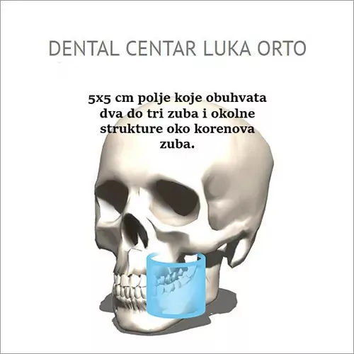 3D SNIMAK S polje 5×5 cm - Dental centar Luka Orto - 1