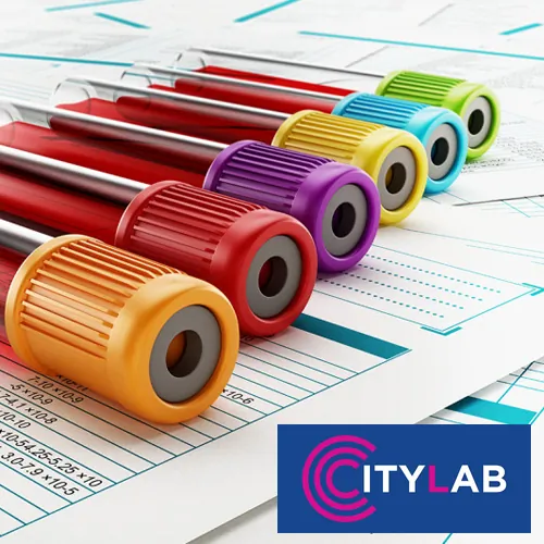 Kompletna krvna slika LABORATORIJA CITYLAB - Biohemijska laboratorija CityLab - 2