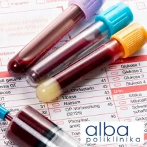Tumor markeri POLIKLINIKA ALBA - Poliklinika Alba - 1