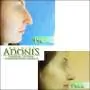 Korekcija nosa ADONIS - Bolnica za estetsku hirurgiju Adonis - 1