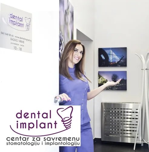 Beljenje zuba DENTAL IMPLANT - Dental Implant - 4