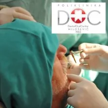 ABATMENT IMPLANT - Stomatološka ordinacija Dental Oral Centar Milošević - 2