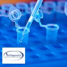 Aspartat aminotransf. (AST) BIODIAGNOSTICA - Biohemijska laboratorija Biodiagnostica - 1