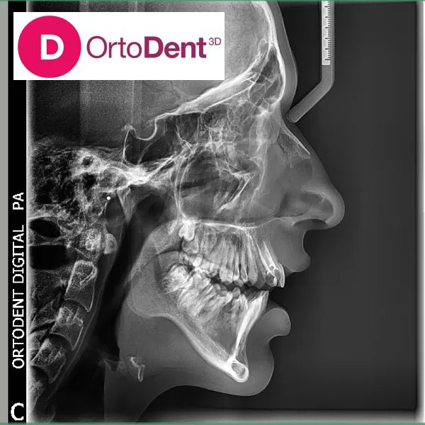 3D POLJE 12X9 ORTO DENT DIGITAL 3D - ORTOPAN CENTAR - Orto Dent Digital 3D - Ortopan centar - 2