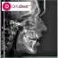 3D POLJE 12X9 ORTO DENT DIGITAL 3D - ORTOPAN CENTAR - Orto Dent Digital 3D - Ortopan centar - 2