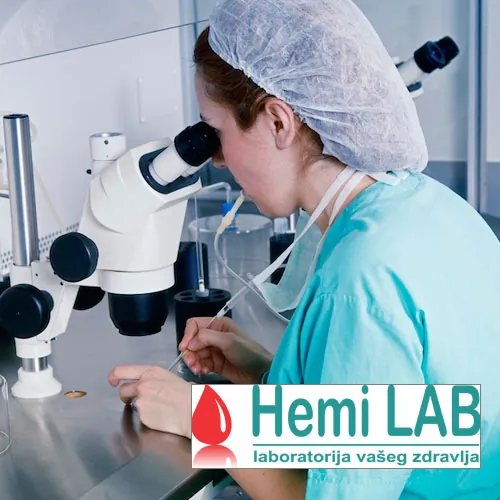 Celokupan pregled urina HEMI LAB - Hemi Lab Laboratorija - 2