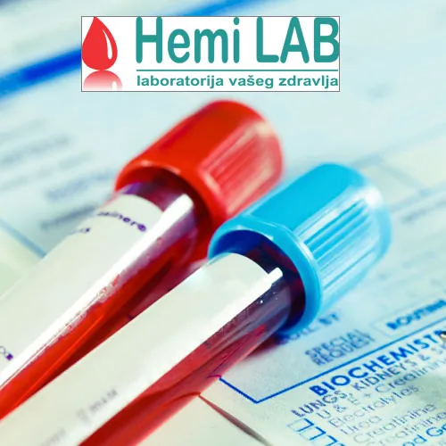 Celokupan pregled urina HEMI LAB - Hemi Lab Laboratorija - 1
