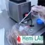 Celokupan pregled urina HEMI LAB - Hemi Lab Laboratorija - 3
