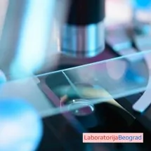 Celokupni pregled urina LABORATORIJA BEOGRAD - Laboratorija Beograd - 1