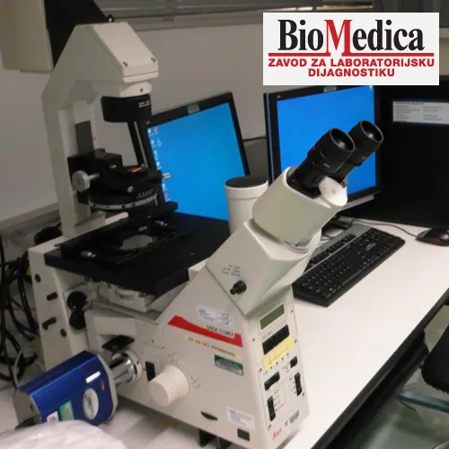 Spermogram BIOMEDICA - Biohemijske laboratorije BIOMEDICA - 2