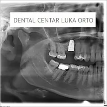 Skanogram DENTAL CENTAR LUKA ORTO - Dental centar Luka Orto - 2