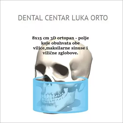 3D SNIMAK XL polje 8×15 - Dental centar Luka Orto - 1