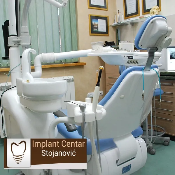 Lasersko beljenje zuba IMPLANT CENTAR STOJANOVIĆ - Implant Centar Stojanović - 1