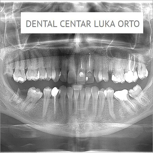 KOPIJA SNIMKA - Dental centar Luka Orto - 1