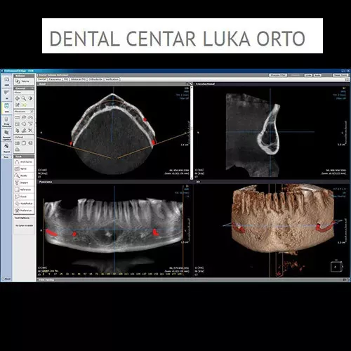 3D SNIMAK M polje 6×8 cm - Dental centar Luka Orto - 2