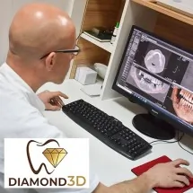 3D CBCT  Malo radno polje  S 5x5 - Centar za snimanje zuba Diamond 3D - 2