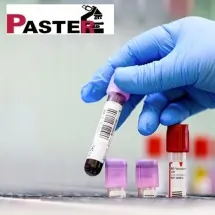Krvna grupa i Rh faktor PASTER - Zavod za laboratorijsku dijagnostiku PASTER - 1